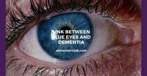 Loss of Depth Perception. . Link between blue eyes and dementia